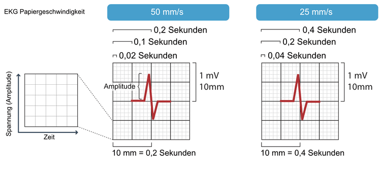 Abbildung 15. Das EKG-Raster.
