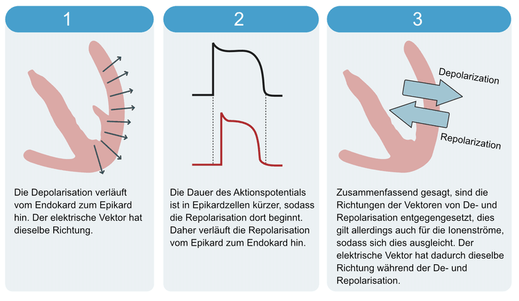 Abbildung 9. Der Vektor der T-Welle. Der Grund, warum die T-Welle normalerweise konkordant zum QRS-Komplex ist, wird hier erläutert.