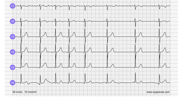 EKG-Testbibliothek: Frage 3