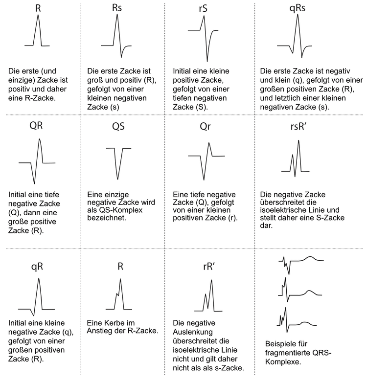 Abbildung 5. Bezeichnung des QRS-Komplexes.