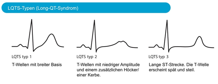 Eigenschaften von T-Wellen bei verschiedenen LQTS-Typen (Long-QT-Syndrom).