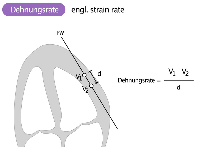Abbildung 4. Dehnungsrate. Die Geschwindigkeit wird in zwei Punkten entlang des Ultraschallstrahls (V1, V2) gemessen. Die Dehungsrate wird berechnet, indem die Geschwindigkeitsdifferenz (V1-V2) durch den Abstand (d) zwischen den Messpunkten geteilt wird.