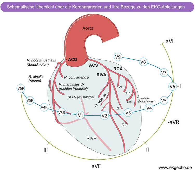 Abbildung 2. Lokalisierung von Koronararterien, Myokard und EKG Ableitungen.