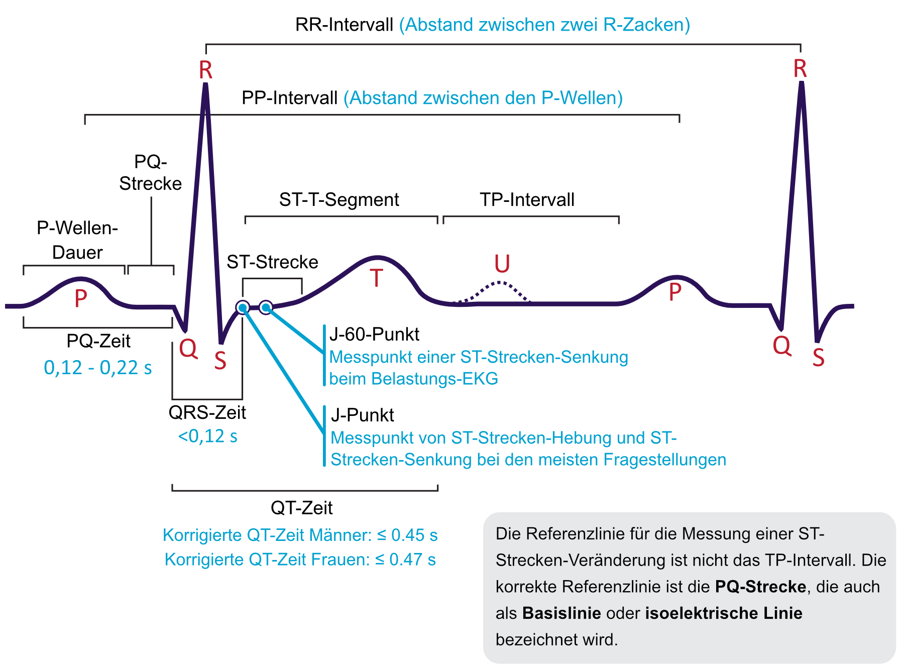 Normale EKG-Kurve mit P-Welle, PQ-Strecke, QRS-Komplex, ST-Strecke und T-Welle