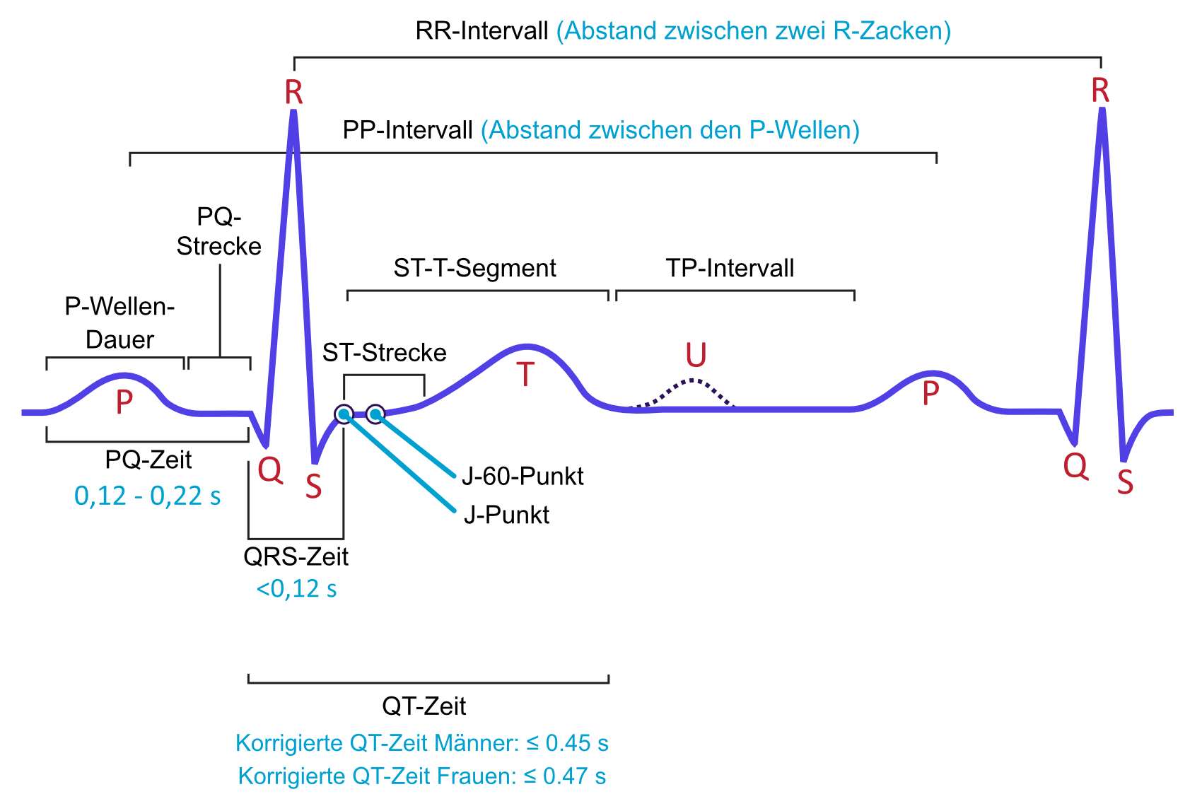EKG-Schema mit Markierung der QT-Zeit vom Beginn des QRS-Komplexes bis zum Ende der T-Welle.